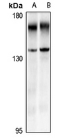 WB - Anti-EVI1 Antibody AP54063