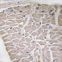 - Anti-Collagen 16 alpha 1 Antibody AP54096