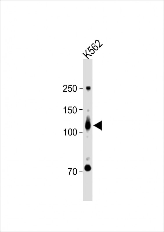 WB - ROR2 Antibody (N-term) AP7672A