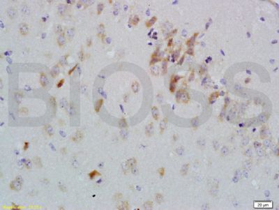 IHC-P - GDNF Receptor alpha 2 Polyclonal Antibody AP54180