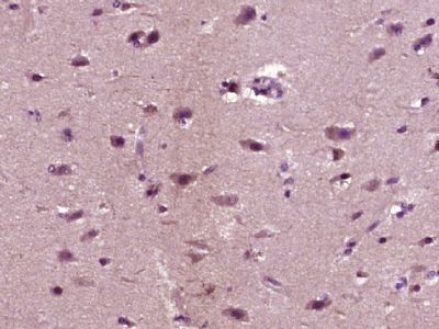 IHC-P - ABCA7 Polyclonal Antibody AP54416