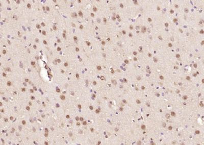 IHC-P - Ataxin 7 Polyclonal Antibody AP54452