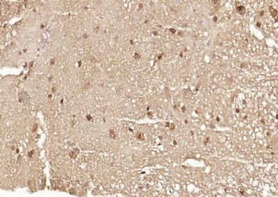 IHC-P - Ataxin 7 Polyclonal Antibody AP54452
