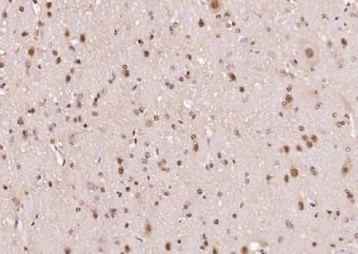 IHC-P - Ataxin 7 Polyclonal Antibody AP54452