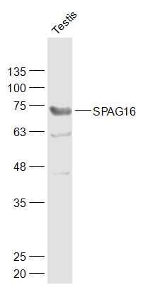 WB - SPAG16 Polyclonal Antibody AP54520