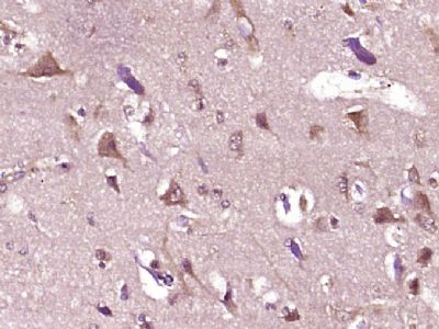 IHC-P - UBXD2 Polyclonal Antibody AP54592