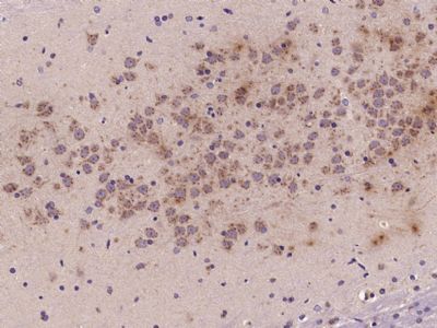 IHC-P - Semaphorin 3D Polyclonal Antibody AP54692