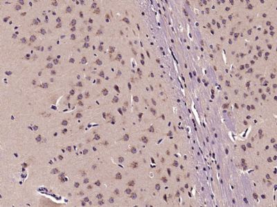 IHC-P - Semaphorin 3D Polyclonal Antibody AP54692