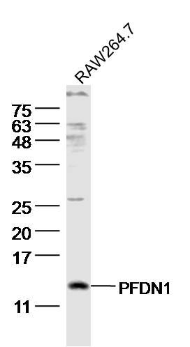 WB - PFDN1 Polyclonal Antibody AP54908