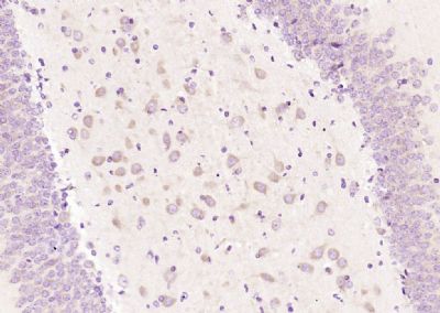 IHC-P - PFDN1 Polyclonal Antibody AP54908