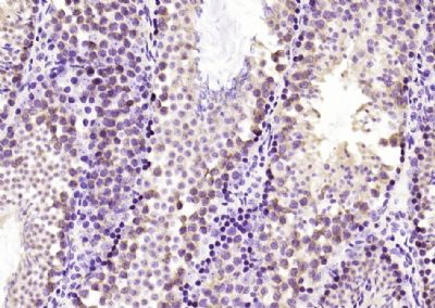 IHC-P - PFDN1 Polyclonal Antibody AP54908