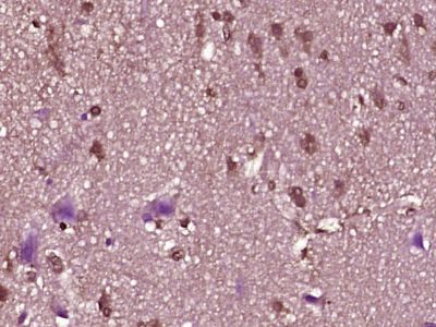 IHC-P - ZNF214 Polyclonal Antibody AP54978