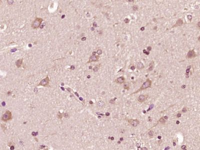 IHC-P - STK11IP Polyclonal Antibody AP54993