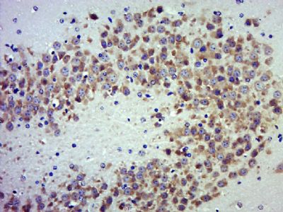 IHC-P - TAF1A Polyclonal Antibody AP55015