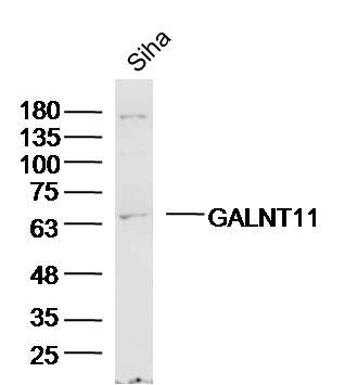 WB - GALNT11 Polyclonal Antibody AP55116
