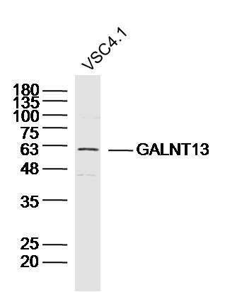 WB - GALNT13 Polyclonal Antibody AP55117
