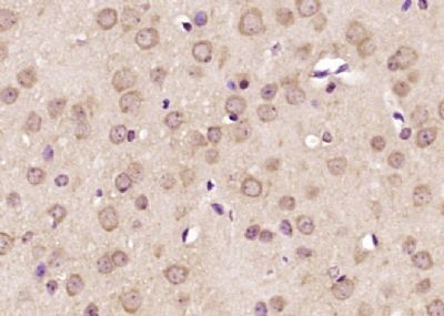 IHC-P - GCC1 Polyclonal Antibody AP55129