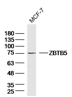 WB - ZBTB5 Polyclonal Antibody AP55211