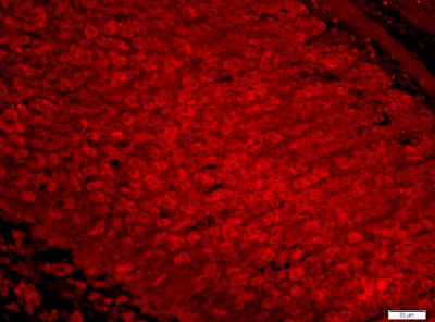 IF - DIP13B Polyclonal Antibody AP55226