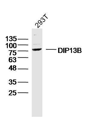WB - DIP13B Polyclonal Antibody AP55226