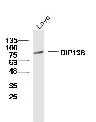 WB - DIP13B Polyclonal Antibody AP55226