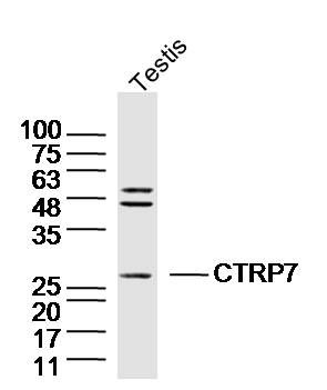 WB - CTRP7 Polyclonal Antibody AP55421