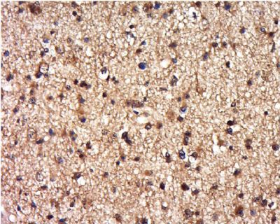 IHC-P - DEPDC1B/BRCC3 Polyclonal Antibody AP55500