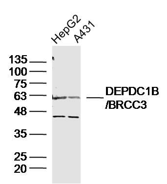 WB - DEPDC1B/BRCC3 Polyclonal Antibody AP55500