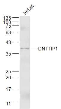 WB - DNTTIP1 Polyclonal Antibody AP55558