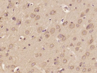 IHC-P - DOLPP1 Polyclonal Antibody AP55561