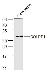 WB - DOLPP1 Polyclonal Antibody AP55561