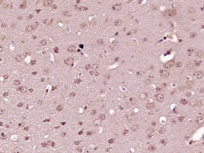 IHC-P - EXOC6 Polyclonal Antibody AP55662