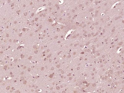 IHC-P - EXOC6 Polyclonal Antibody AP55662