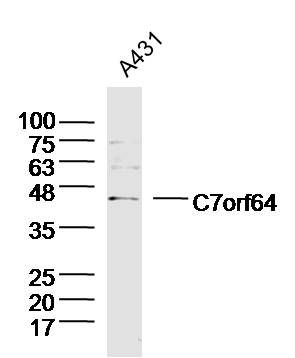 WB - C7orf64 Polyclonal Antibody AP55916