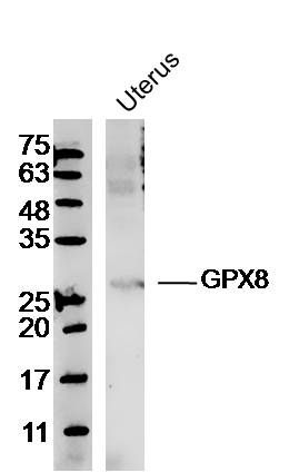 WB - GPX8 Polyclonal Antibody AP56208