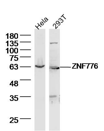 WB - ZNF776 Polyclonal Antibody AP56281