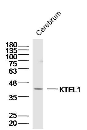 WB - KTEL1 Polyclonal Antibody AP56443