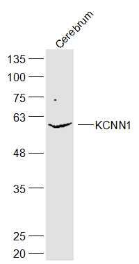 WB - KCNN1 Polyclonal Antibody AP56464