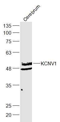 WB - KCNV1 Polyclonal Antibody AP56467