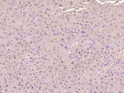 IHC-P - HOXD1 Polyclonal Antibody AP56675