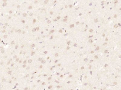 IHC-P - HUS1 Polyclonal Antibody AP56952