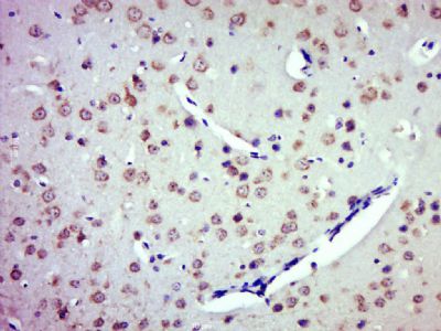 IHC-P - ZDHHC8/ZNF378 Polyclonal Antibody AP57109