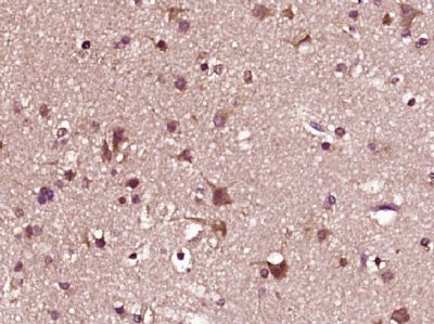 IHC-P - ZC3HAV1L/C7orf39 Polyclonal Antibody AP57135