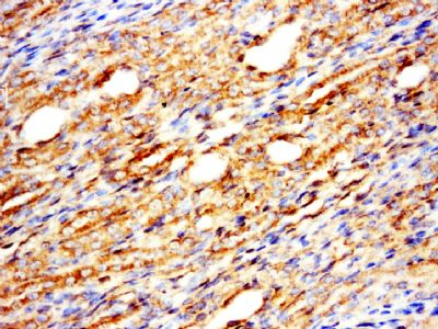 IHC-P - Melanophilin Polyclonal Antibody AP57248