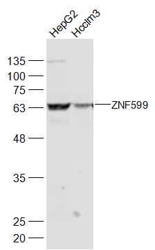 WB - ZNF599 Polyclonal Antibody AP57565