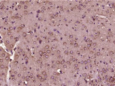 IHC-P - SGSM2 Polyclonal Antibody AP57645