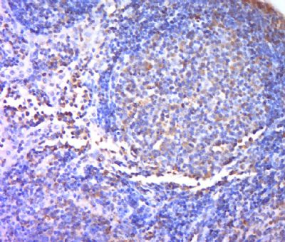 IHC-P - TREML1 Polyclonal Antibody AP58053
