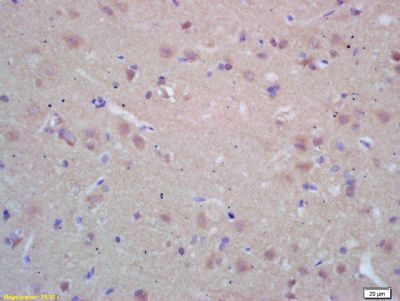 IHC-P - NAT2 Polyclonal Antibody AP58059