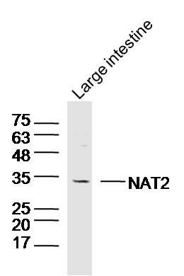 WB - NAT2 Polyclonal Antibody AP58059