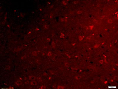 IF - Netrin G1 ligand Polyclonal Antibody AP58495